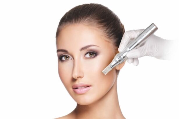 Microneedling Schulung